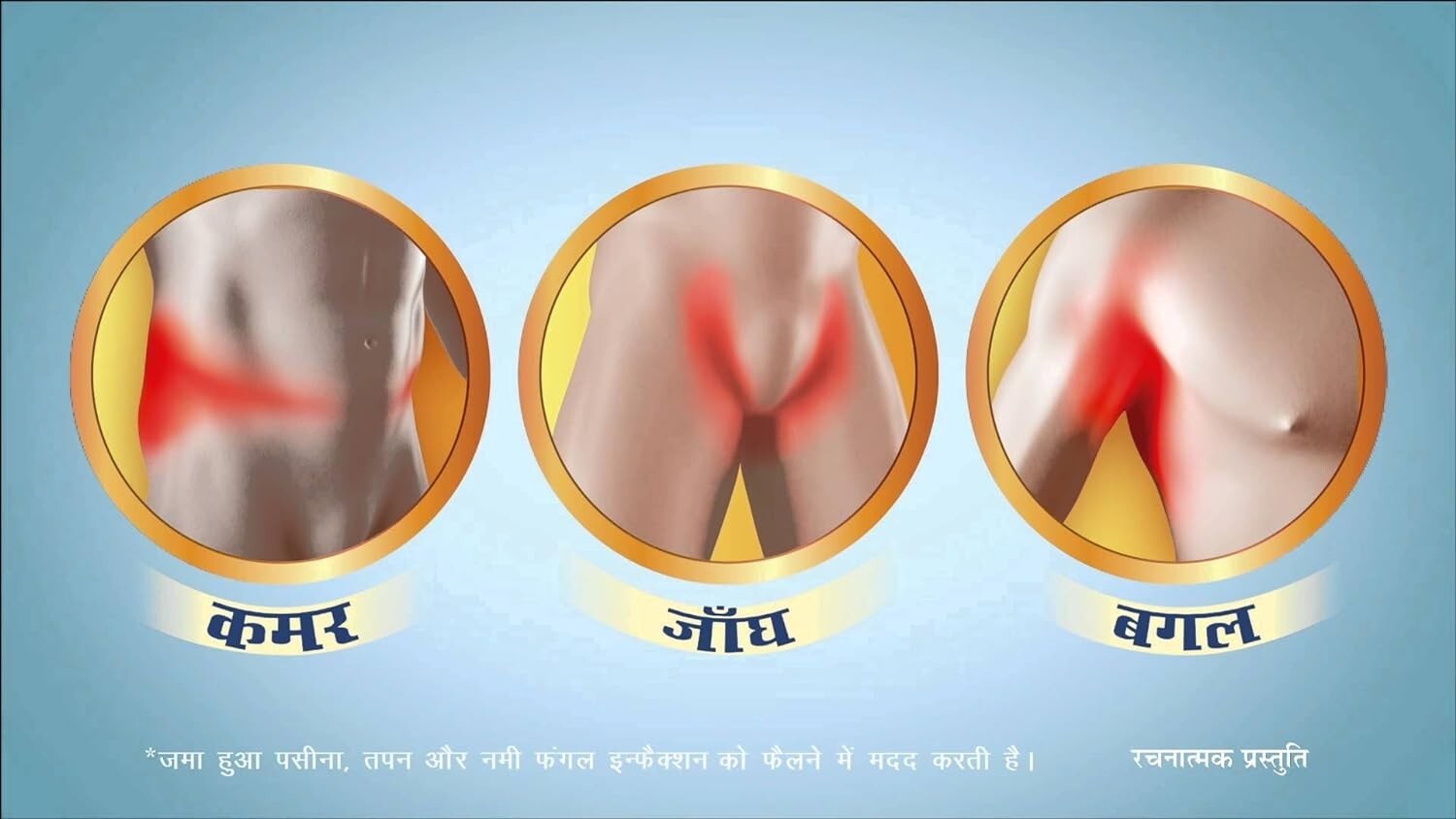 Itch Guard for Itching & Rashes 25gm (Pack of 4)  Free Shipping