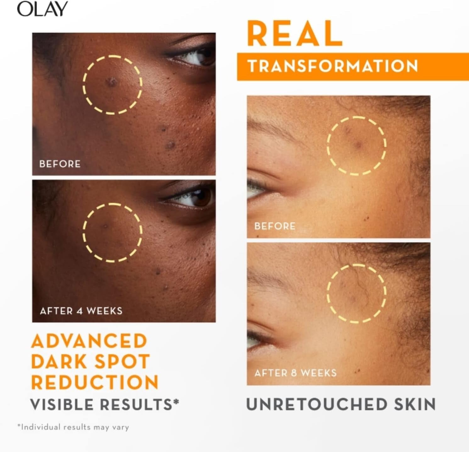 Olay Luminous Niacinamide + Vitamin C Super Serum - 30ml  Free Shipping