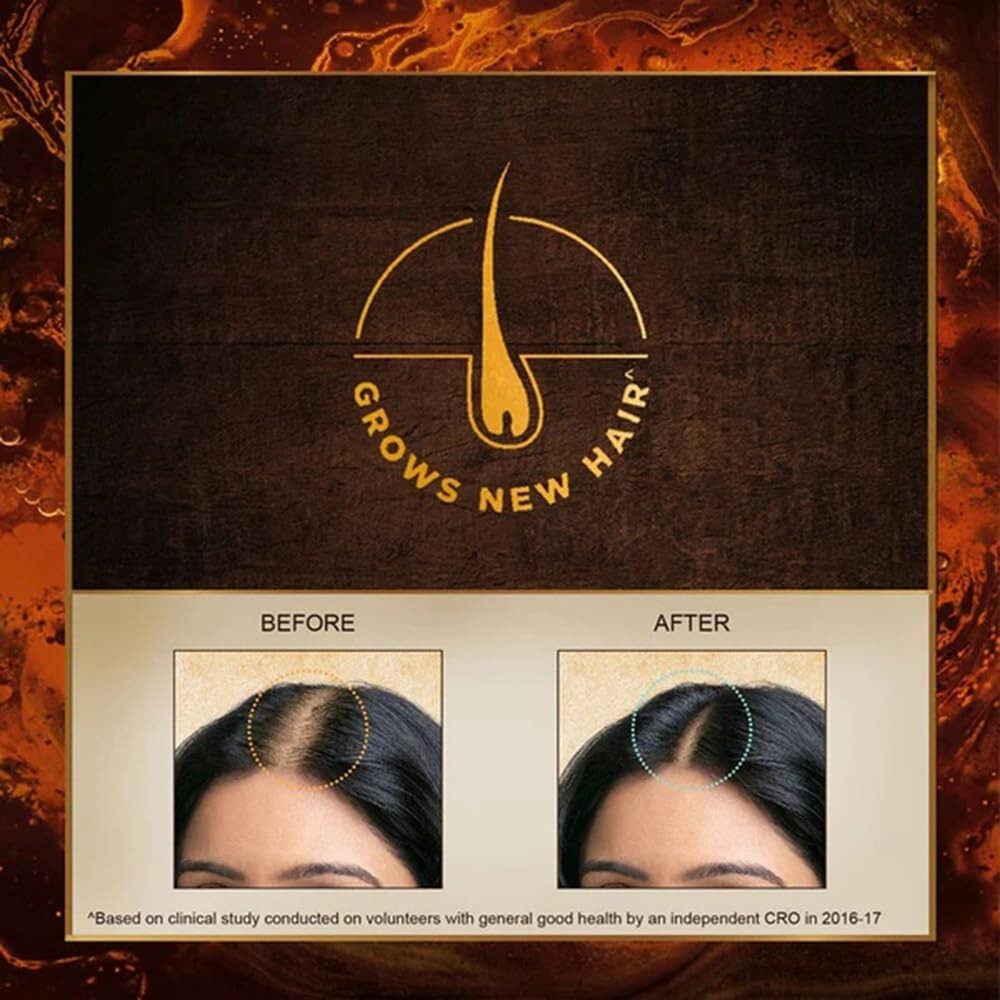 Indulekha Bringha Complete Hair Care Oil 100ml (Pack of 3)  Free Shipping