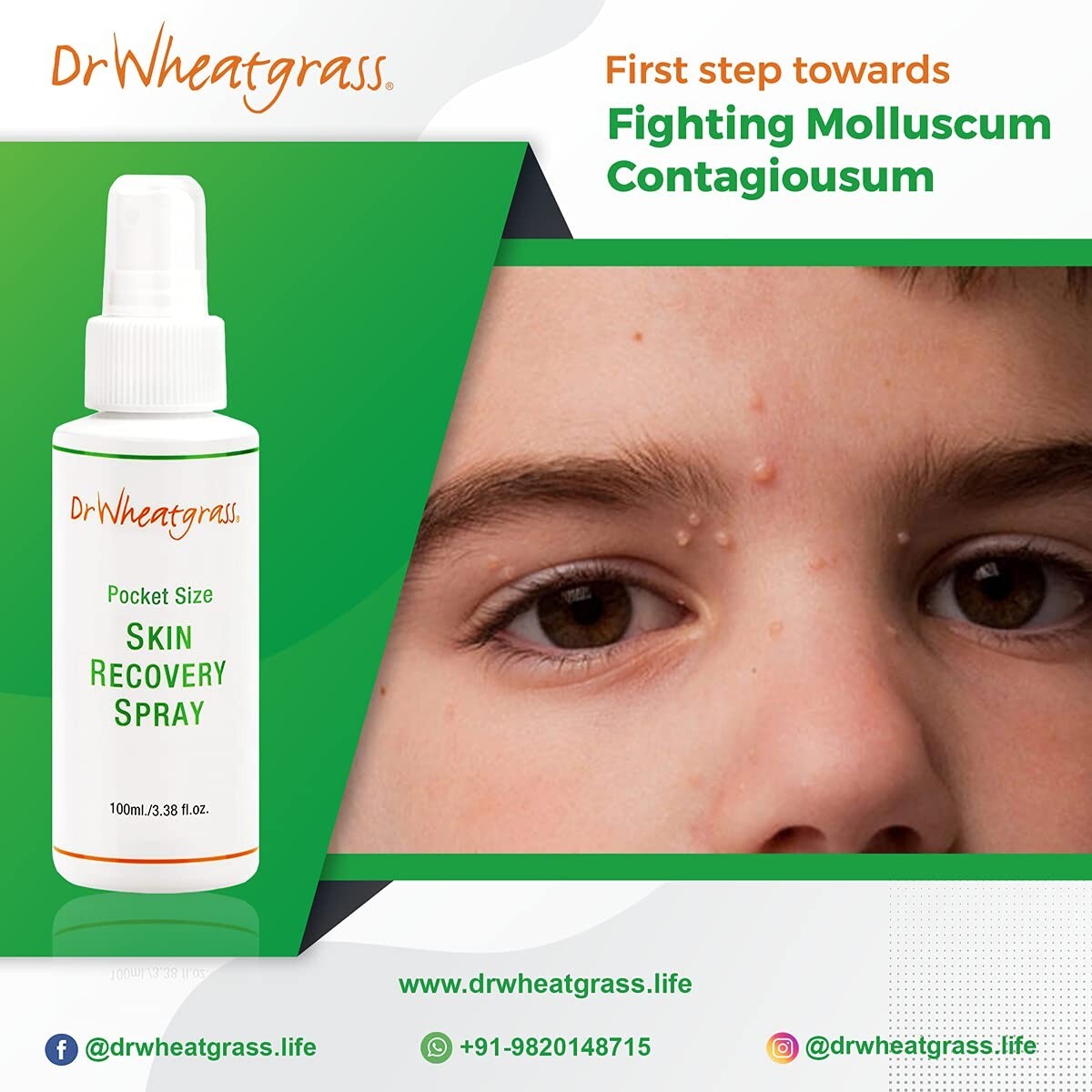 Dr Wheatgrass Skin Recovery Spray - 175ml  Free Shipping